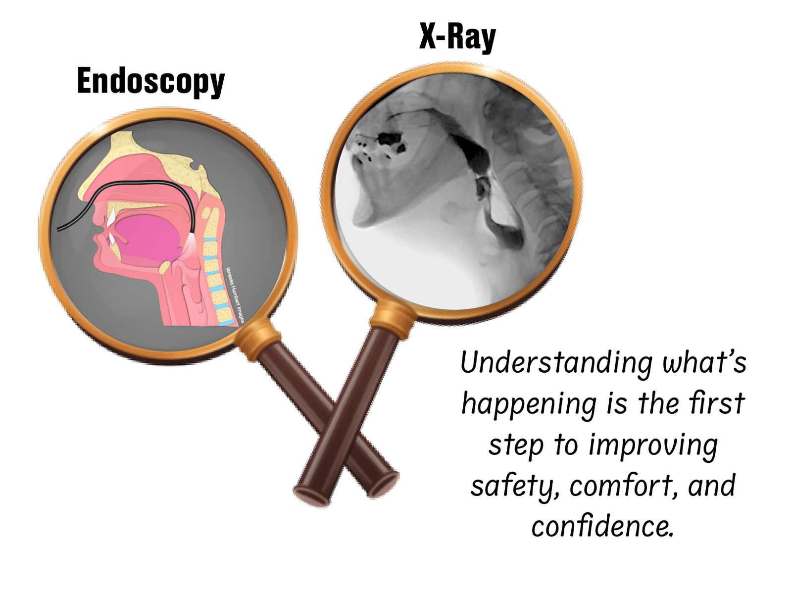 Dr. Humbert's comparison of an endoscopic swallow study and a swallowing X-ray